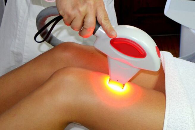 Laserové odstraňovanie chĺpkov