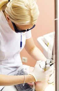 Lekár vykonáva postup fototermolýzy