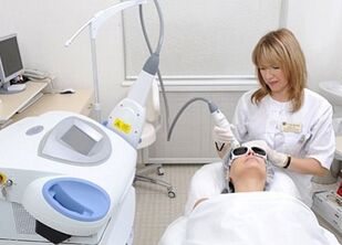 klady a zápory frakčného omladenia pokožky tváre pomocou laseru